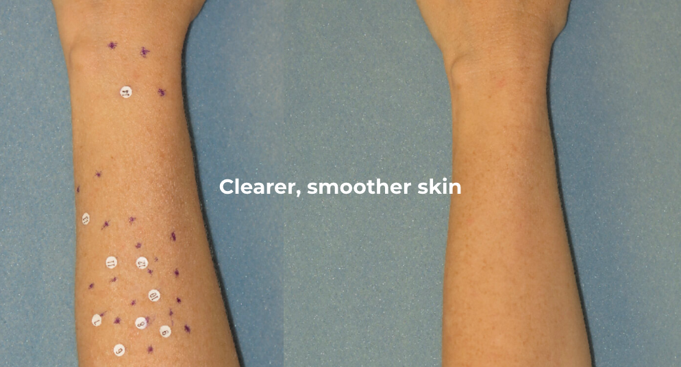 Images of arms