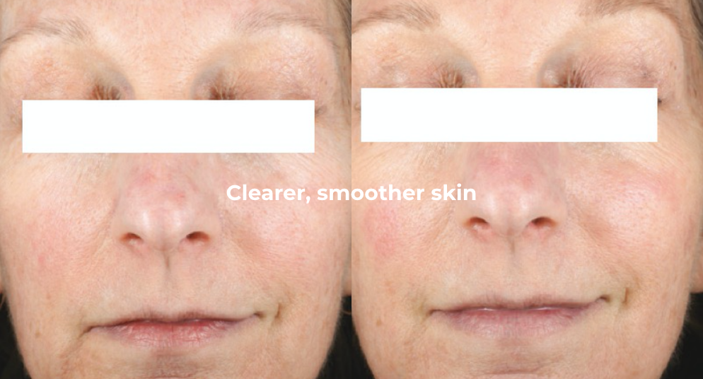 mages of woman’s face